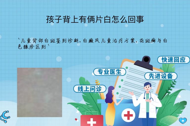 孩子背上有俩片白怎么回事