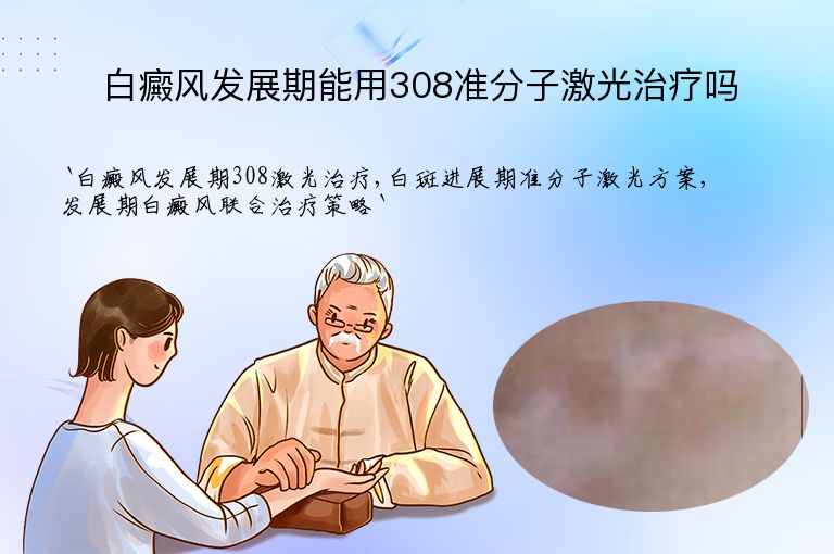 白癜风发展期能用308准分子激光治疗吗”