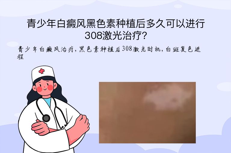 青少年白癜风黑色素种植后多久可以进行308激光治疗？”