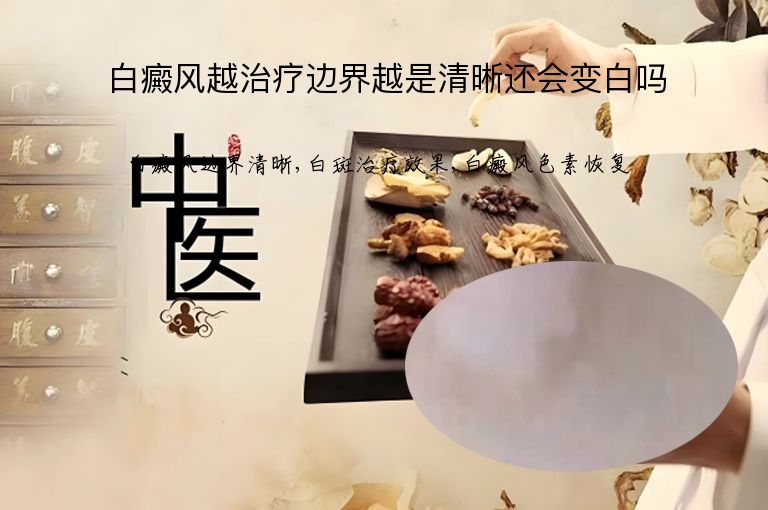 白癜风越治疗边界越是清晰还会变白吗”