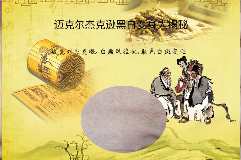 迈克尔杰克逊黑白变身大揭秘”