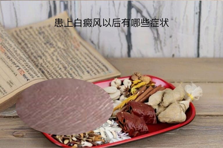 https://www.bdfsjzyy.com/d/file/p/372ef15ff56523109e9c59fc4174c180.jpeg