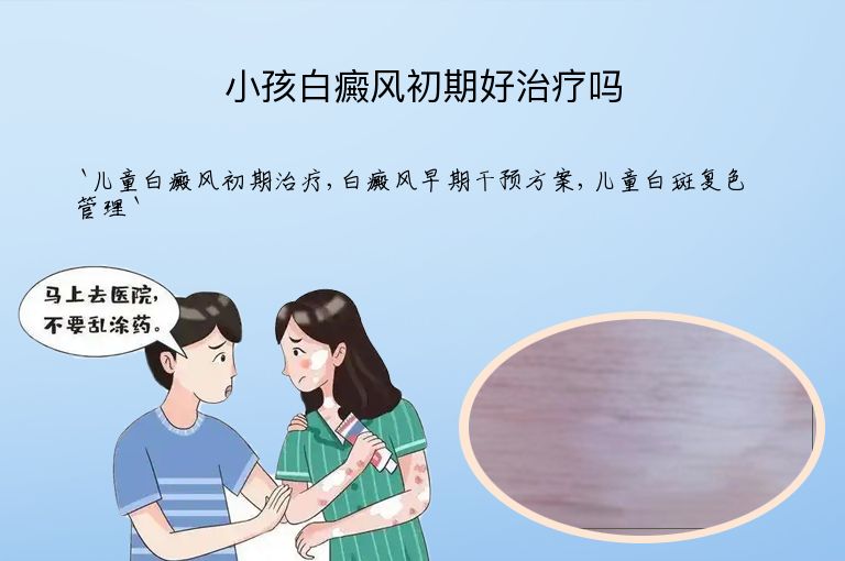 小孩白癜风初期好治疗吗