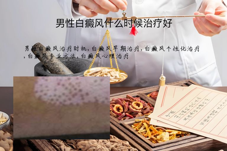 男性白癜风什么时候治疗好”