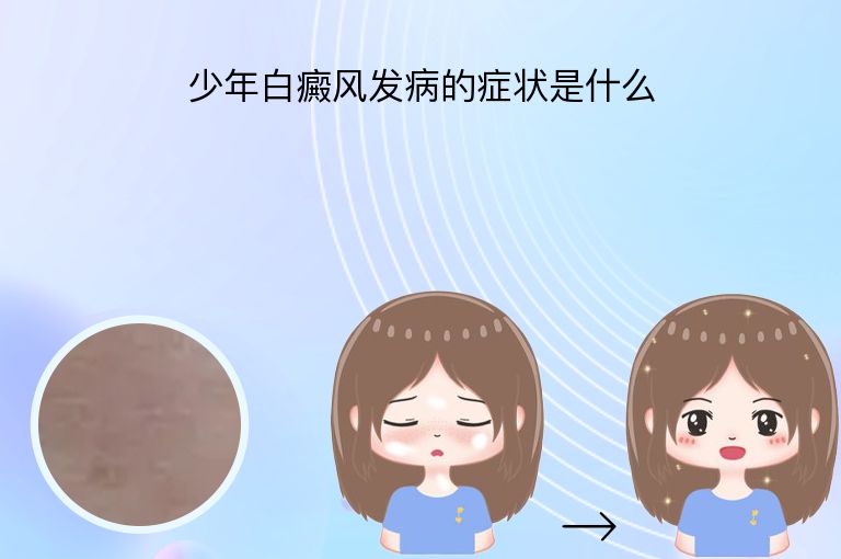 少年白癜风发病的症状是什么”