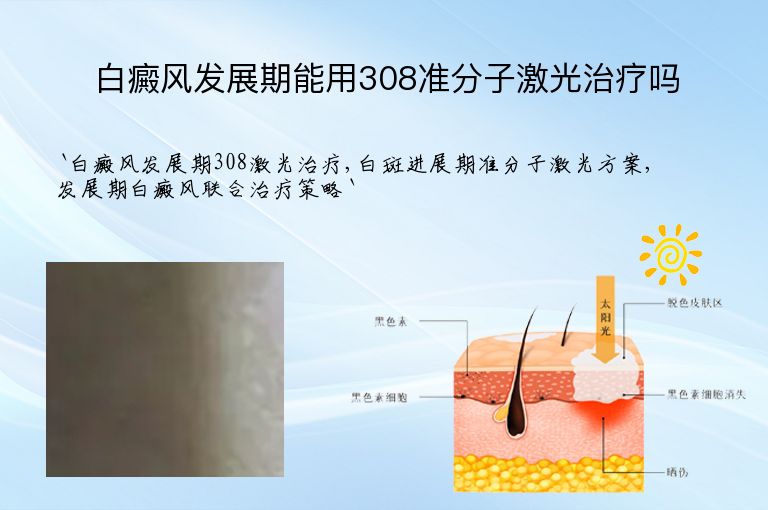 https://www.bdfsjzyy.com/d/file/p/d84cfd35b68ccb5dcf5455f2d7e0bbbd.jpeg