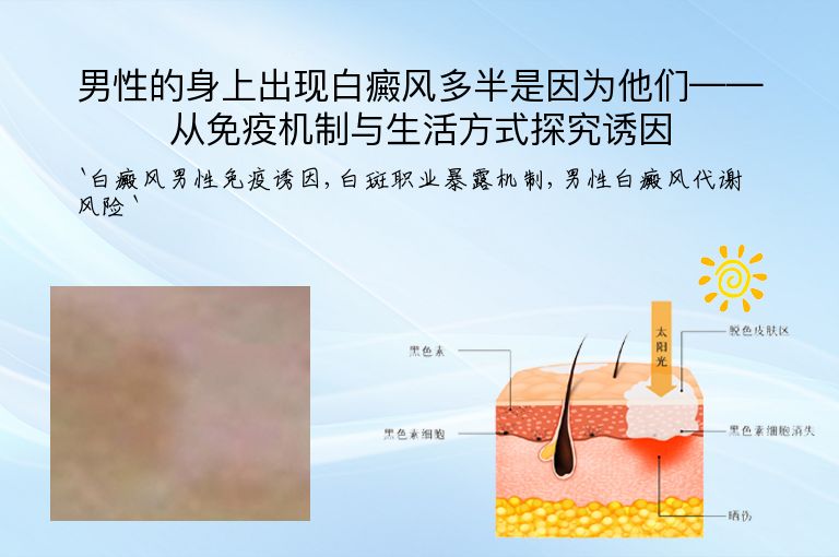 男性的身上出现白癜风多半是因为他们——从免疫机制与生活方式探究诱因