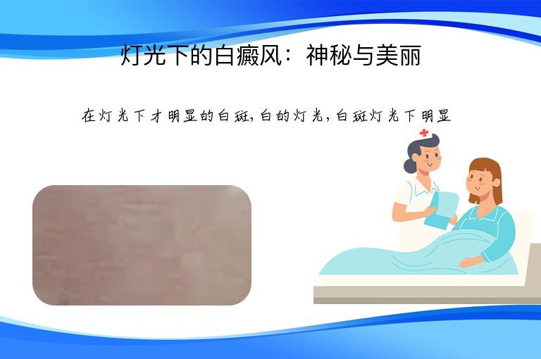 灯光下的白癜风:神秘与美丽”