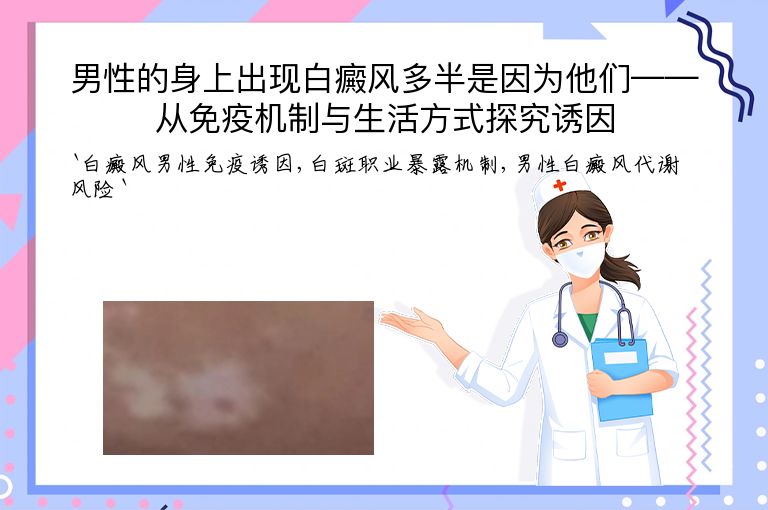 男性的身上出现白癜风多半是因为他们——从免疫机制与生活方式探究诱因