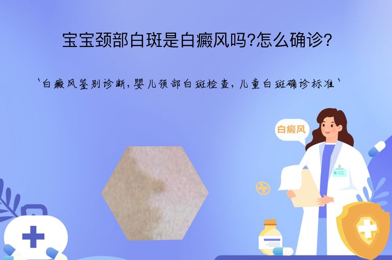 宝宝颈部白斑是白癜风吗?怎么确诊?”