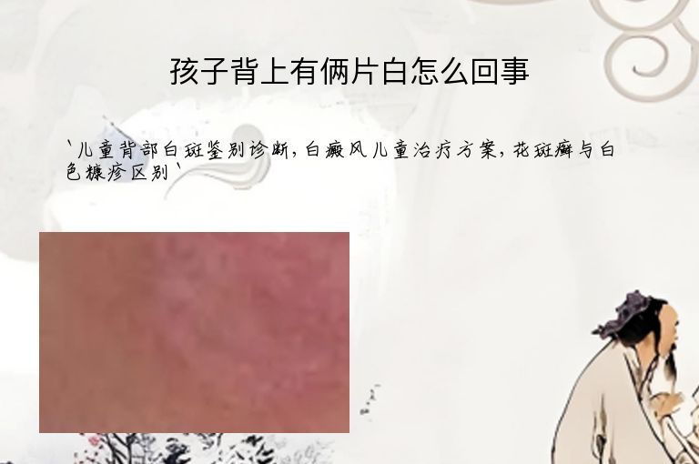 孩子背上有俩片白怎么回事