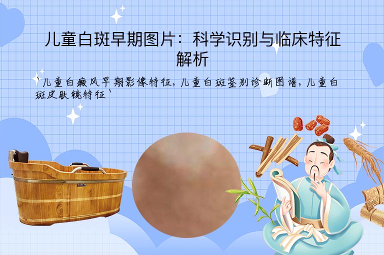 儿童白斑早期图片:科学识别与临床特征解析