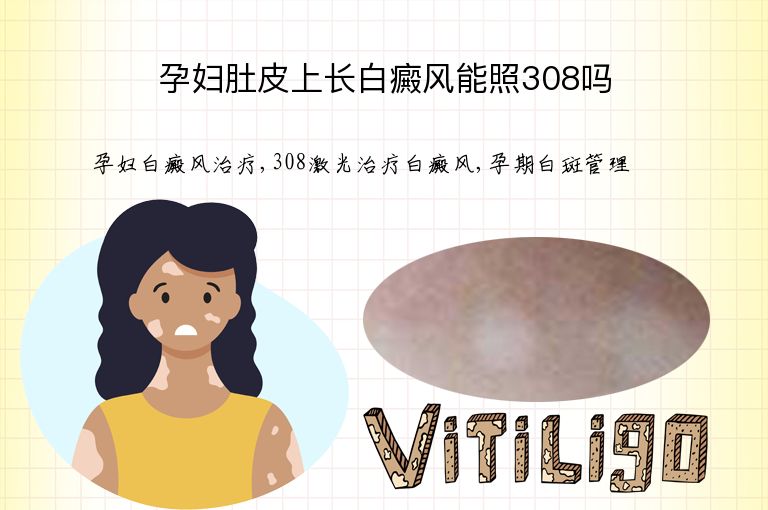https://www.bdfsjzyy.com/d/file/p/651fbb59c122cb2f7f24fe6b4527ff58.jpeg
