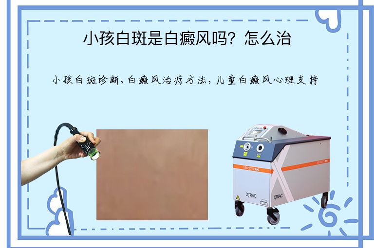 小孩白斑是白癜风吗？怎么治”