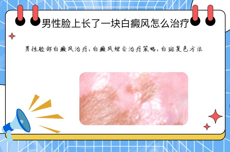 男性脸上长了一块白癜风怎么治疗”