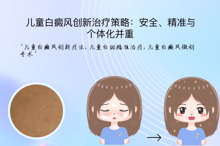 儿童白癜风创新治疗策略:安全、精准与个体化并重