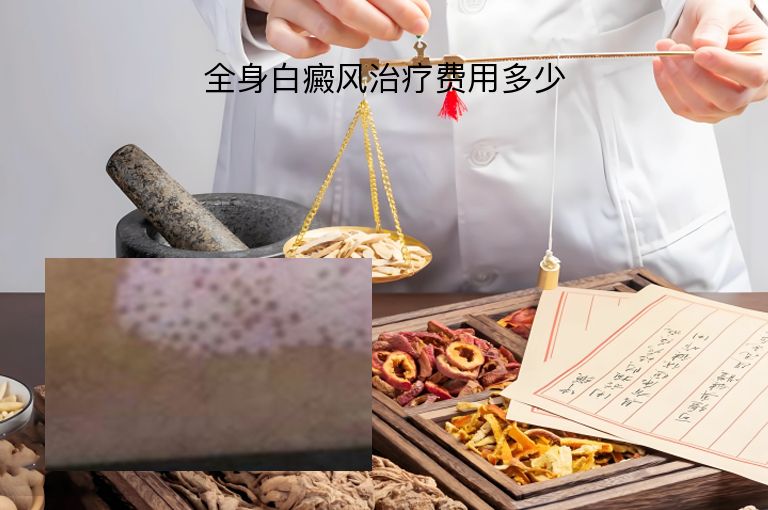 https://www.bdfsjzyy.com/d/file/p/5991812630a3ce573fd2f3441e0afe73.jpeg