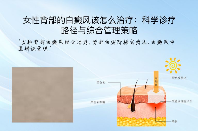 女性背部的白癜风该怎么治疗:科学诊疗路径与综合管理策略