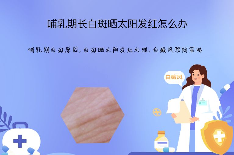 哺乳期长白斑晒太阳发红怎么办”