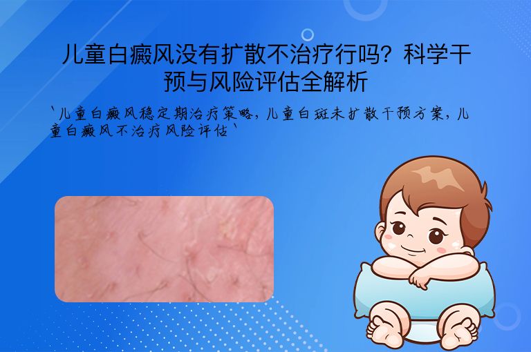 儿童白癜风没有扩散不治疗行吗?科学干预与风险评估全解析