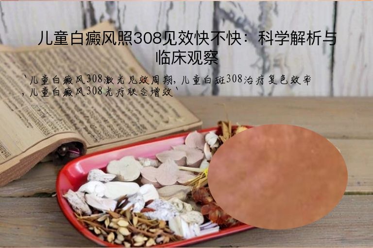儿童白癜风照308见效快不快：科学解析与临床观察