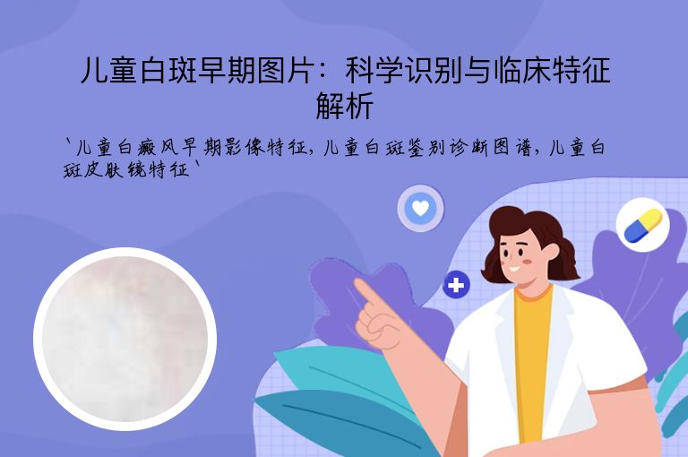 儿童白斑早期图片:科学识别与临床特征解析