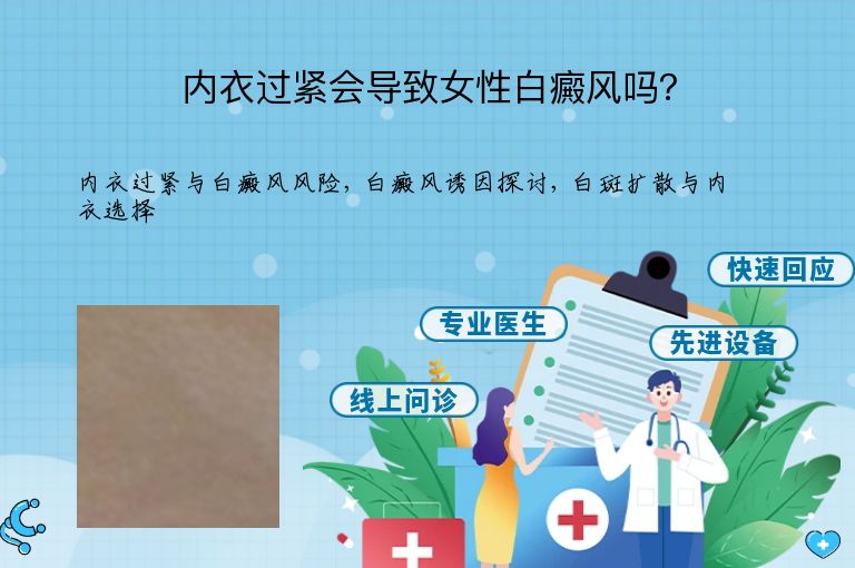 内衣过紧会导致女性白癜风吗？”