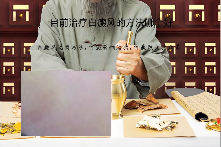 目前治疗白癜风的方法哪个好”