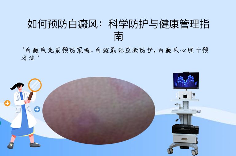 如何预防白癜风:科学防护与健康管理指南