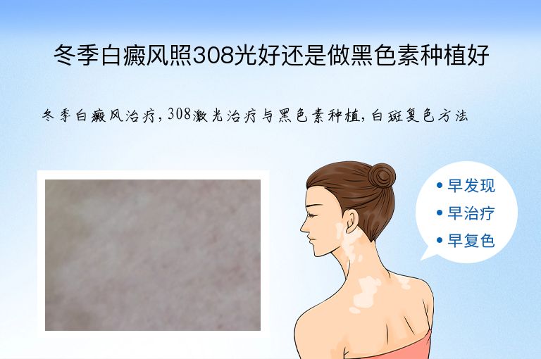 冬季白癜风照308光好还是做黑色素种植好”