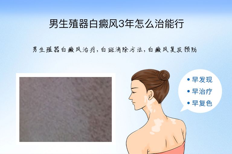 男生殖器白癜风3年怎么治能行”