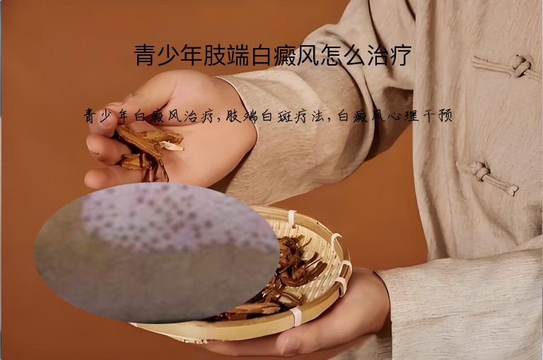 青少年肢端白癜风怎么治疗”