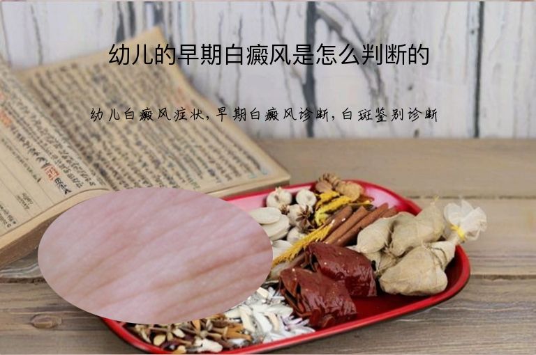 https://www.bdfsjzyy.com/d/file/p/ca64cc1d3ac81c07052d6a0da8310a2b.jpeg