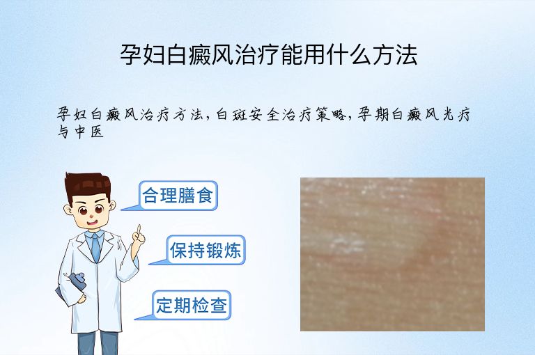 孕妇白癜风治疗能用什么方法”