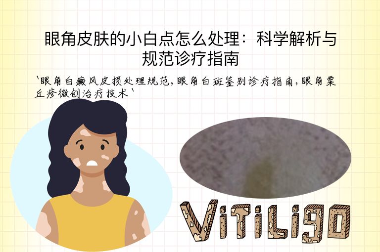 眼角皮肤的小白点怎么处理：科学解析与规范诊疗指南