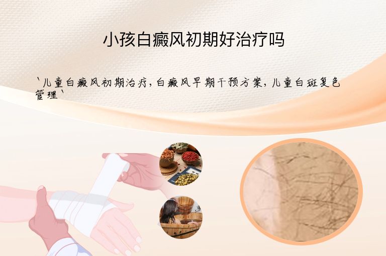 小孩白癜风初期好治疗吗