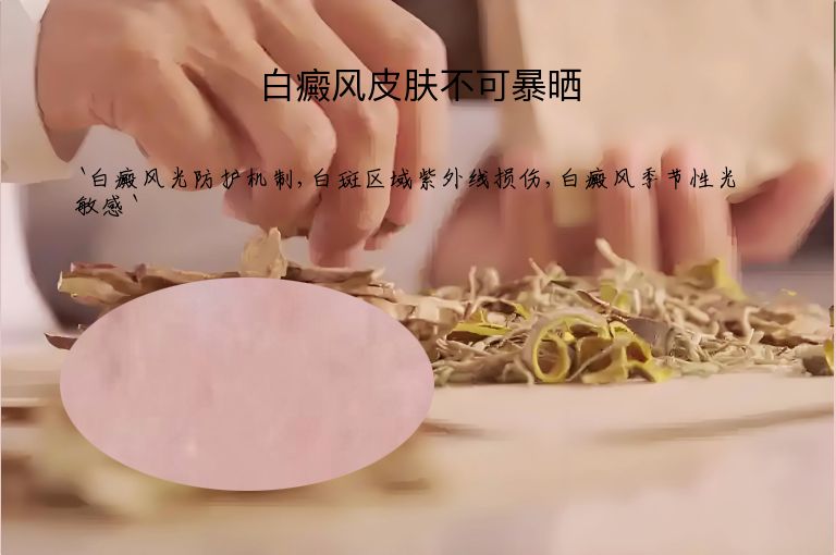白癜风皮肤不可暴晒