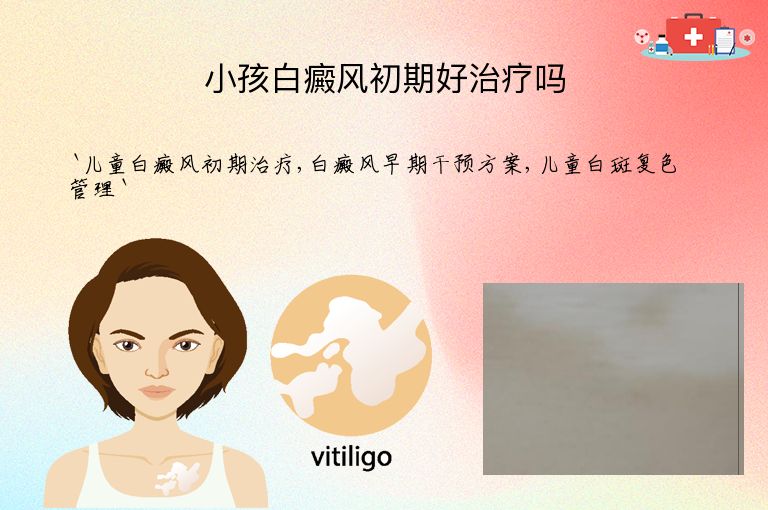 小孩白癜风初期好治疗吗