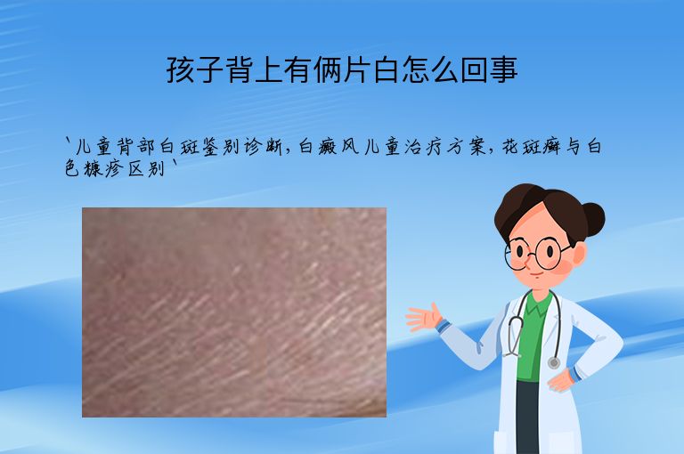 孩子背上有俩片白怎么回事
