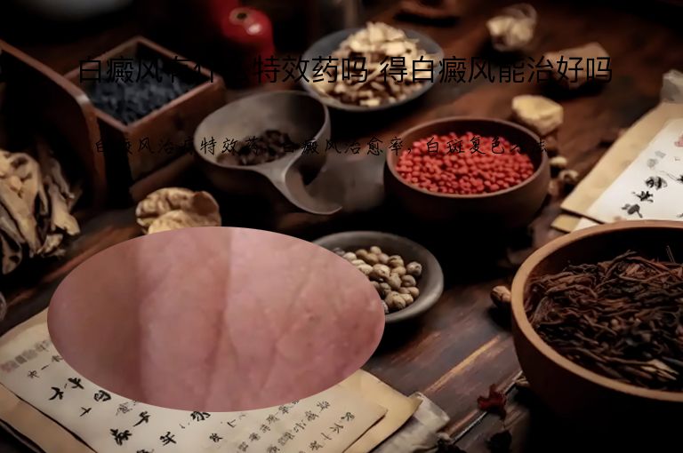 白癜风有什么特效药吗 得白癜风能治好吗”
