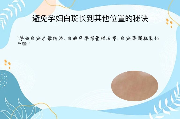 避免孕妇白斑长到其他位置的秘诀