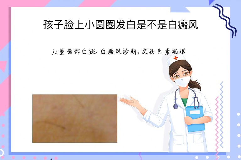 https://www.bdfsjzyy.com/d/file/p/cc319acd4a7970c57abe1e07b84bf1e8.jpeg