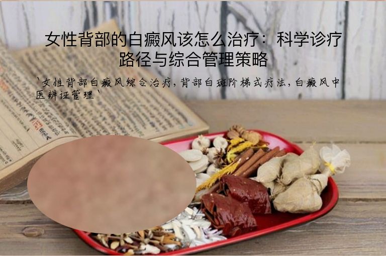 女性背部的白癜风该怎么治疗：科学诊疗路径与综合管理策略