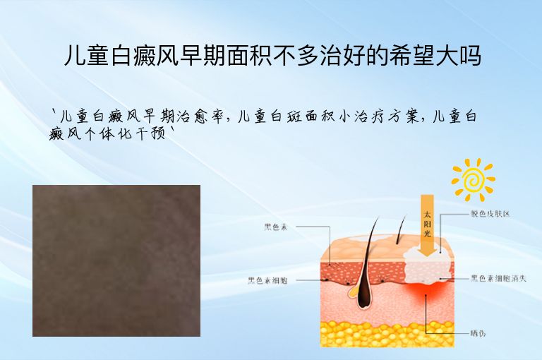 https://www.bdfsjzyy.com/d/file/p/bddd0baedc143f8fe8b9f7a5f181dea4.jpeg