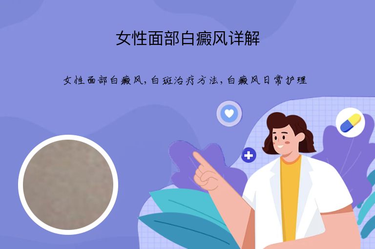 女性面部白癜风详解”