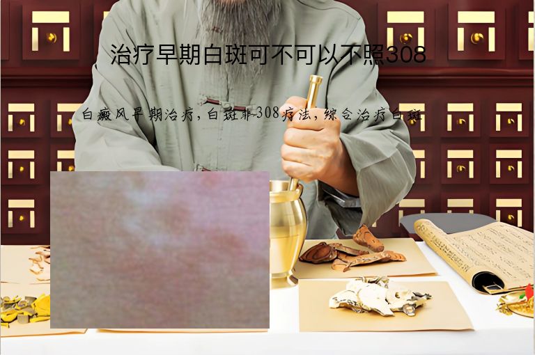 治疗早期白斑可不可以不照308”
