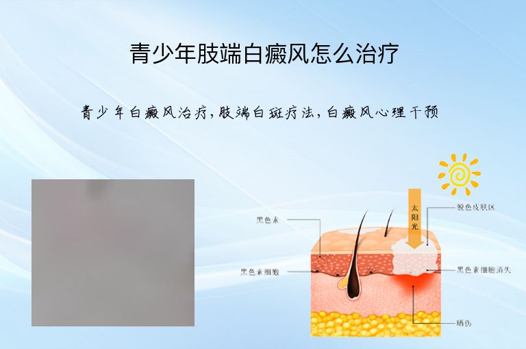青少年肢端白癜风怎么治疗”