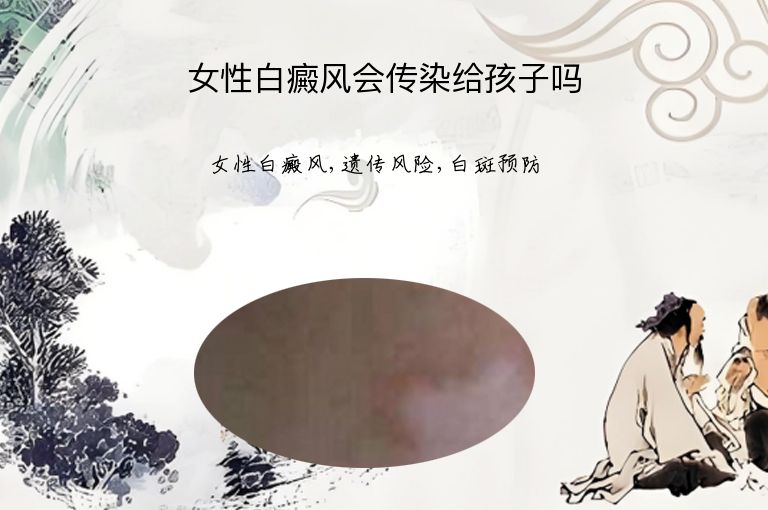 女性白癜风会传染给孩子吗”