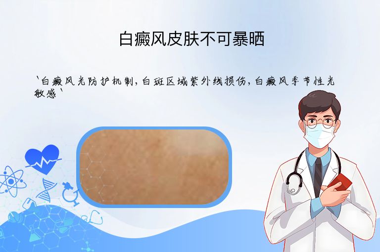 白癜风皮肤不可暴晒