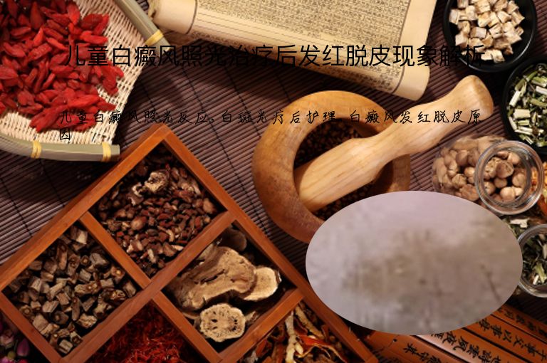 儿童白癜风照光治疗后发红脱皮现象解析”
